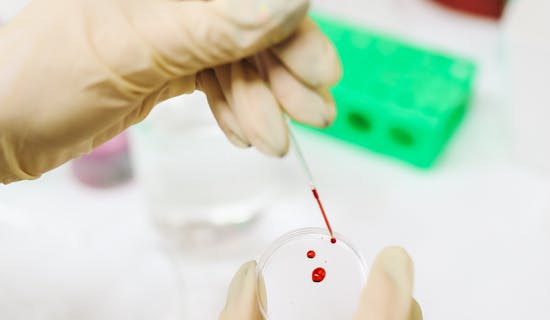 怀孕几个月可以做dna亲子鉴定